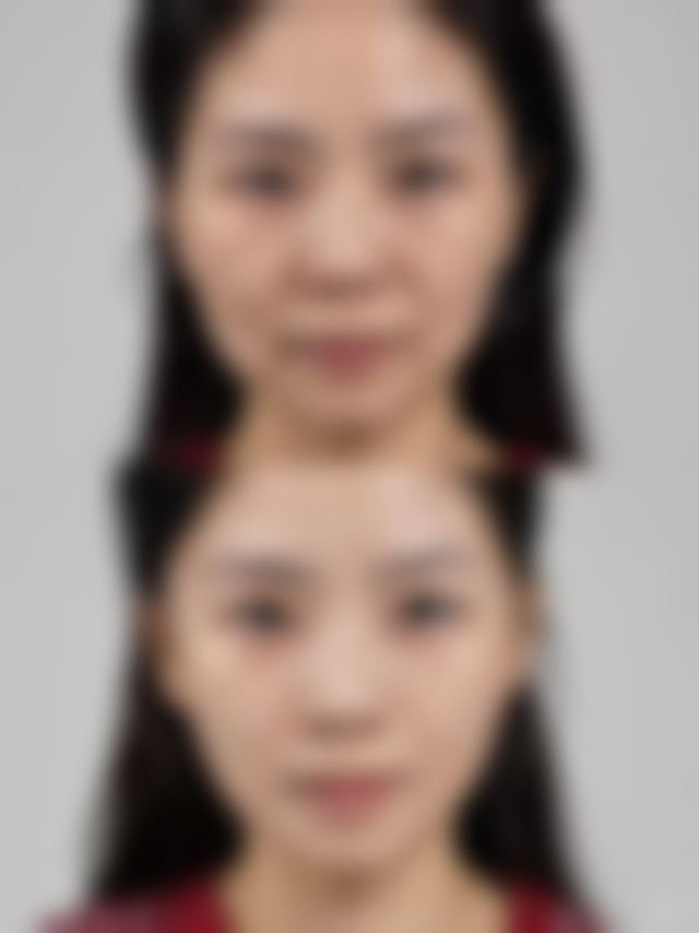 八、成都美熹医疗美容诊所真实的顾客评价如下：