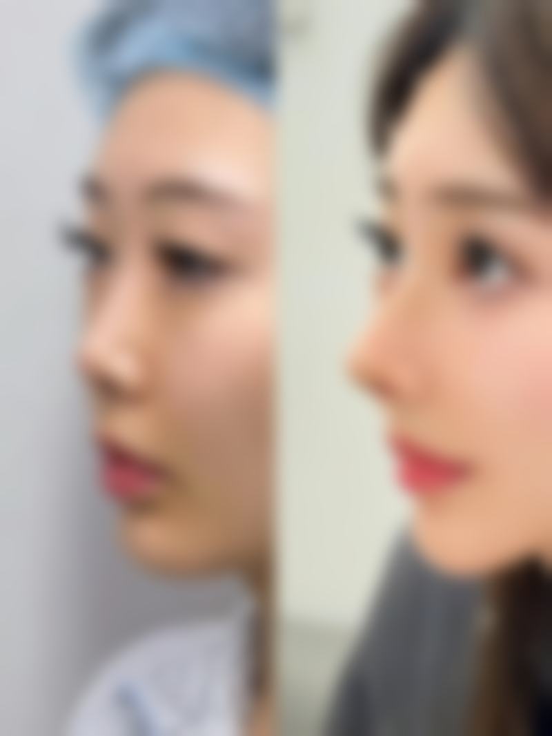 八、江西赣州亚韩医疗美容门诊真实的顾客评价如下：