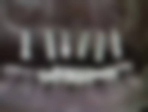 还在愁日常怎么预防眼袋泪沟？这些护理方法特别实用