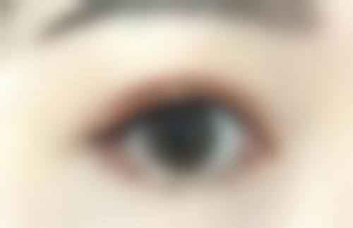 五、唐山恩瑜整形医院实例