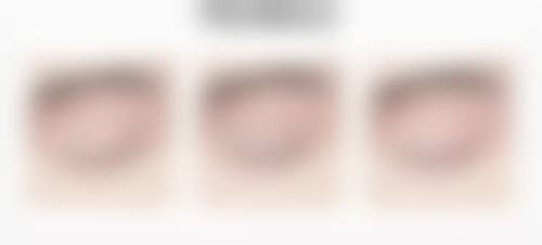 七、深圳园美整形医院价格表：（仅供参考）