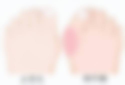 探究根源：愈合过程外力影响及肉芽组织变化怎样造就凹陷疤痕？