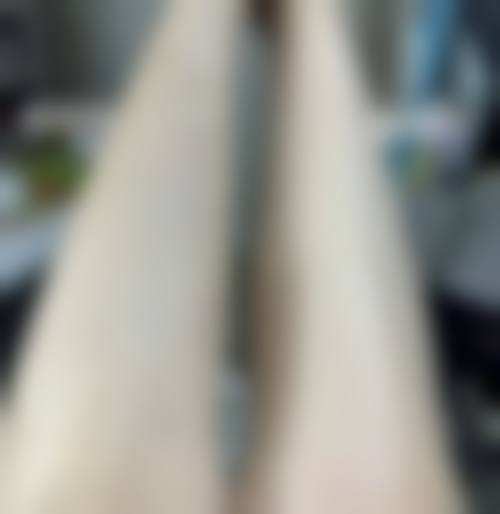 七、银川美诺医学美容诊所价格表：（仅供参考）