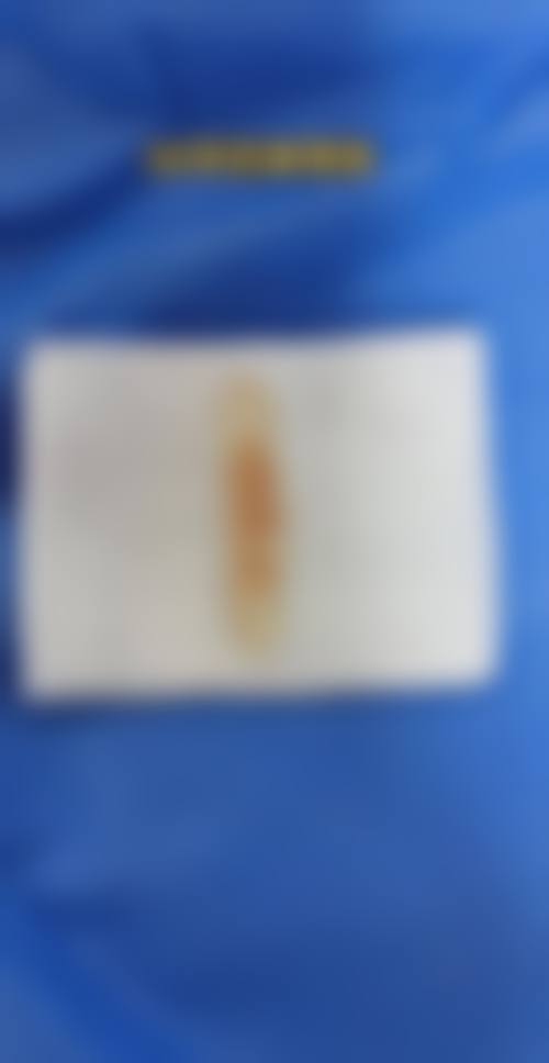 五、衡阳大姐大医学美容诊所实例