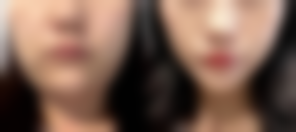 六、深圳悦她医疗美容门诊部怎么预约：