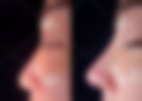 四、郑州美葩整形医院实例