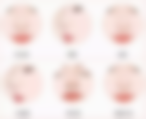 全切双眼皮修复自然，配套注意事项不能忘