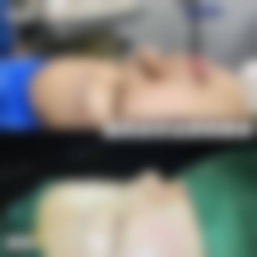 五、张家界伊佰佳桦美整形医院实例