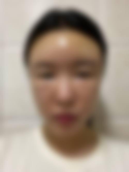 六、太原芮思米医疗美容怎么预约：