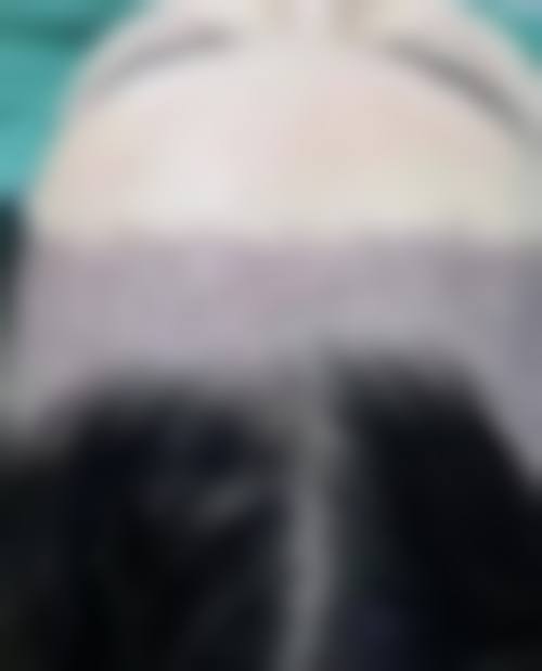 叶锦医生在哪家医院