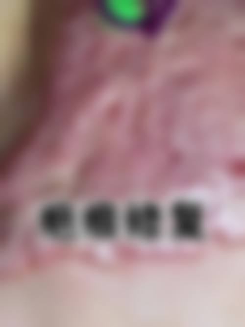 叶锦医生口碑和评价