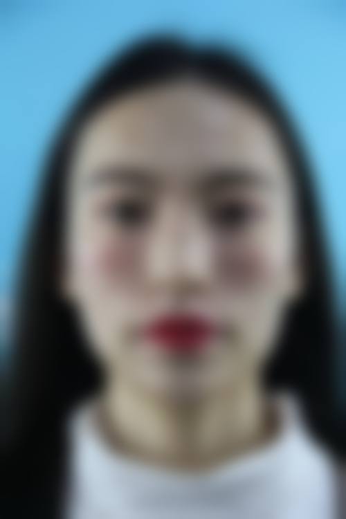 七、北京成铭医疗美容诊所价格表：（仅供参考）