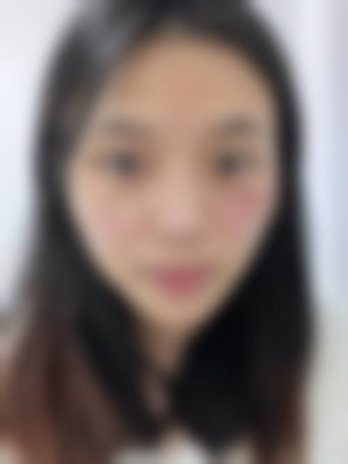 五、太原伊美整形门诊部怎么预约：