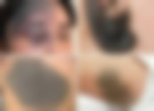 七、太原伊美整形门诊部真实的顾客评价如下：