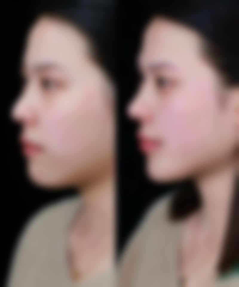 六、河南协和医院整形外科怎么预约：