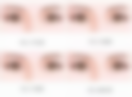 德国热熔眼袋技术：适用人群与安心性保护