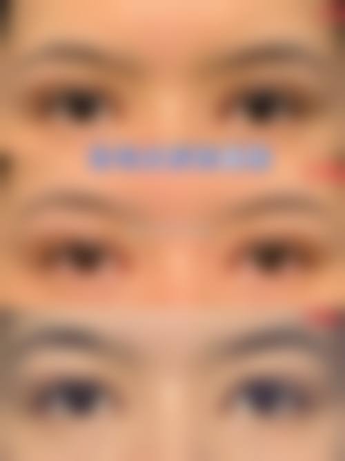 七、襄阳市西子整形医疗美容医院价格表：（仅供参考）