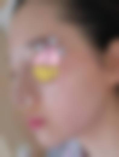 四、乌鲁木齐紫星医疗整形美容实例