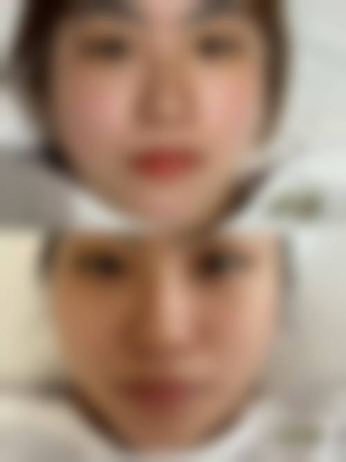 八、佛山凯润婷国内外整形美容医院真实的顾客评价如下：