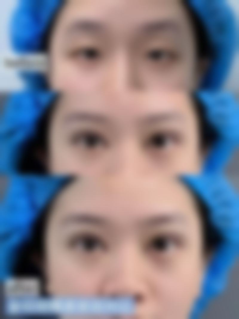 四、大连广普医疗美容整形实例