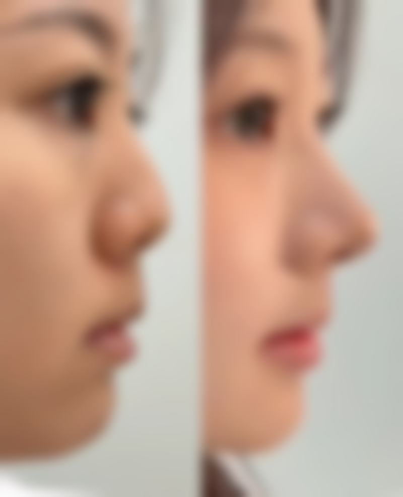 八、襄阳市西子整形医疗美容医院真实的顾客评价如下：