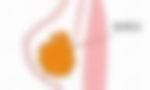 眼睛哭肿有眼袋别慌！物理消肿、习惯调整等多招助你快速改善眼况