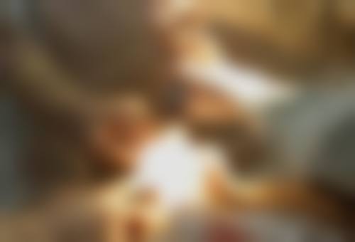 五、扬州秋颜喜整形医院实例