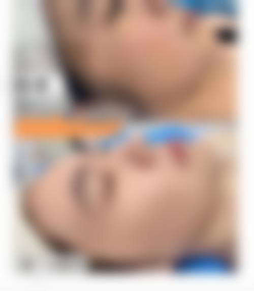 六、杭州承希医疗美容诊所怎么预约：