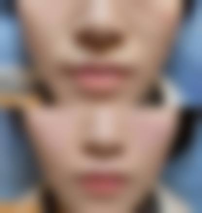 四、杭州倩兮医疗美容诊所开展的主要项目和特色项目：