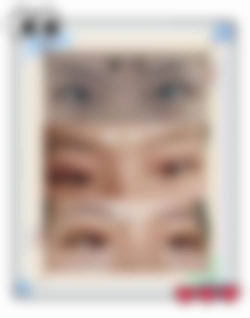 八、南方医 科 大学南方医院整形科真实的顾客评价如下