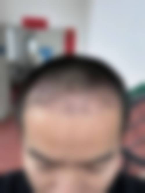 八、扬州秋颜喜整形医院真实的顾客评价如下：