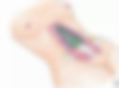 甲状腺手术疤痕怎么遮？衣物选择有诀窍