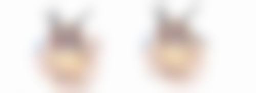 甲状腺手术疤痕怎么遮？装饰衣物贴片齐上阵，临时美肤又减压！ 
