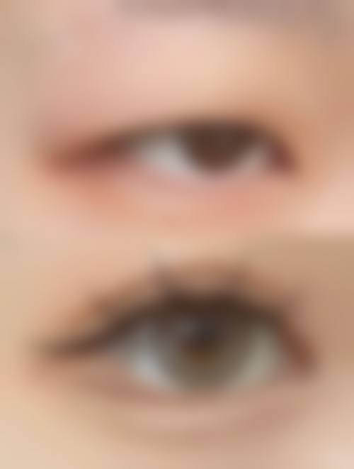 八、无锡即美整形医院真实的顾客评价如下: