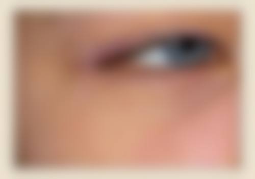 五、韩国奥纳比整容外科实例