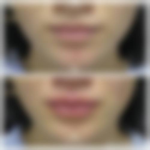 七、沙市区美啦医疗美容门诊部价格表：（仅供参考）