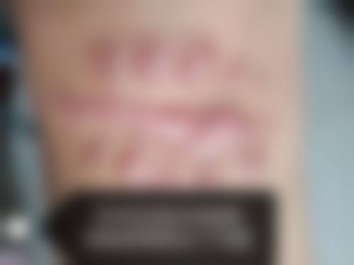 八、成都妤悦整形医疗美容门诊部真实的顾客评价如下: