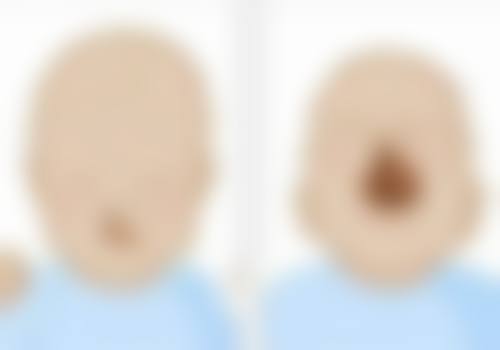 六、北京知音蕊丽医院怎么预约: