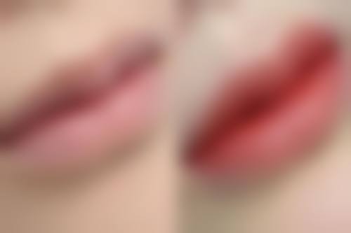 八、北京知音蕊丽医院真实的顾客评价如下: