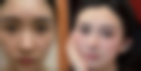 四、普洱悦里整形医院开展的主要项目和特色项目: