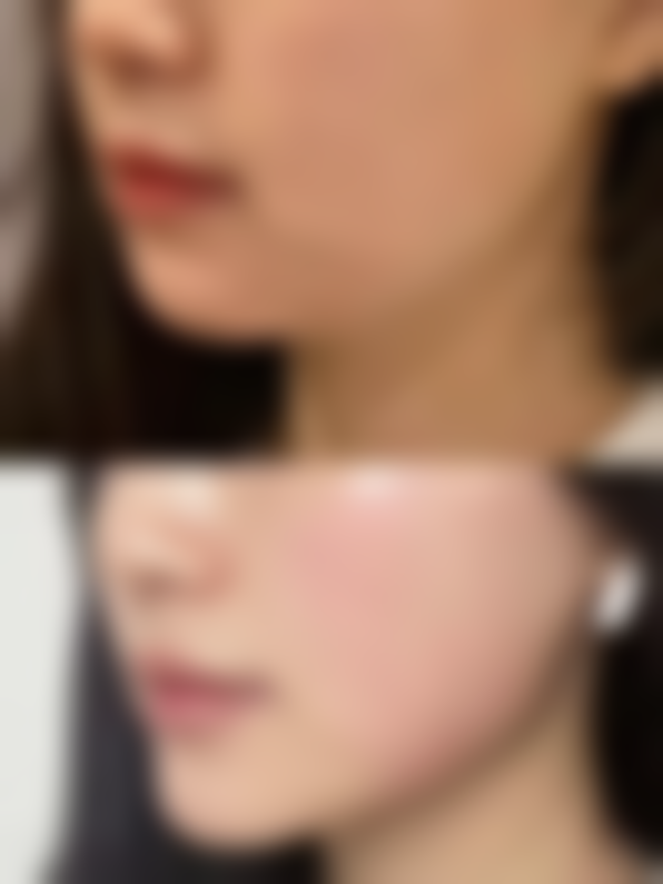 八、普洱悦里整形医院真实的顾客评价如下: