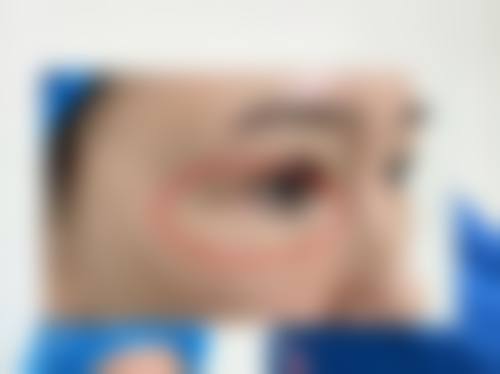 五、牡丹江尹金哲整形医疗美容门诊部实例