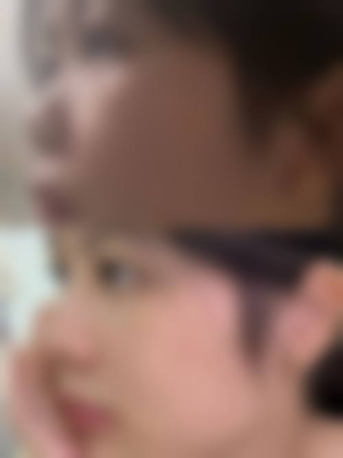 五、济南聚美整形医疗美容诊所实例