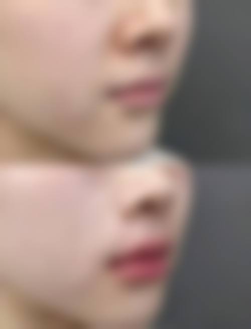 八、济南聚美整形医疗美容诊所真实的顾客评价如下：