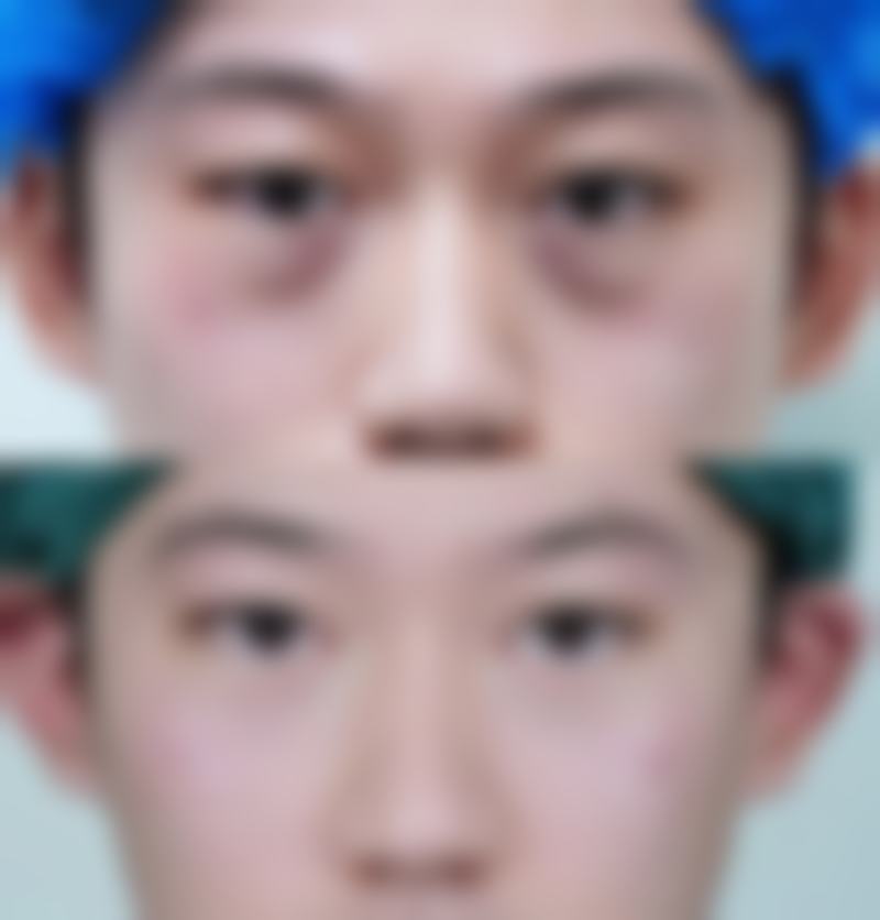 八、牡丹江尹金哲整形医疗美容门诊部真实的顾客评价如下: