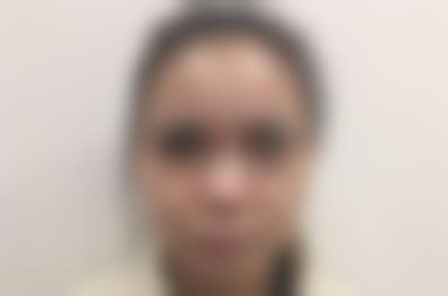 还在为痘疤发愁？化学剥脱有妙招