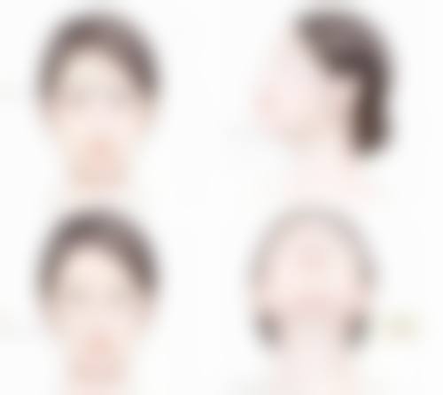 50岁做全切双眼皮，术后修复与护理要点有啥？