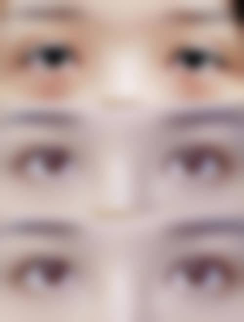 六、福州博美医疗整形美容门诊部怎么预约: