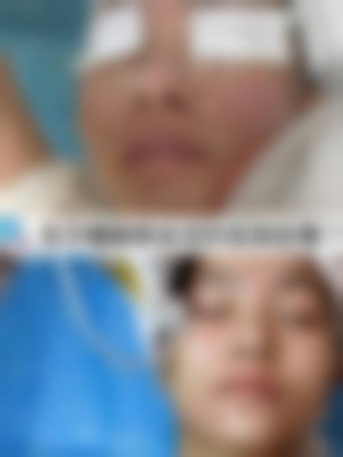 温丽霞医生项目价格表参考