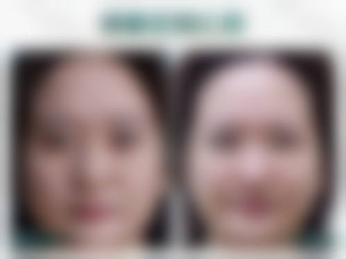 七、乐山川杰医疗美容诊所真实的顾客评价如下：